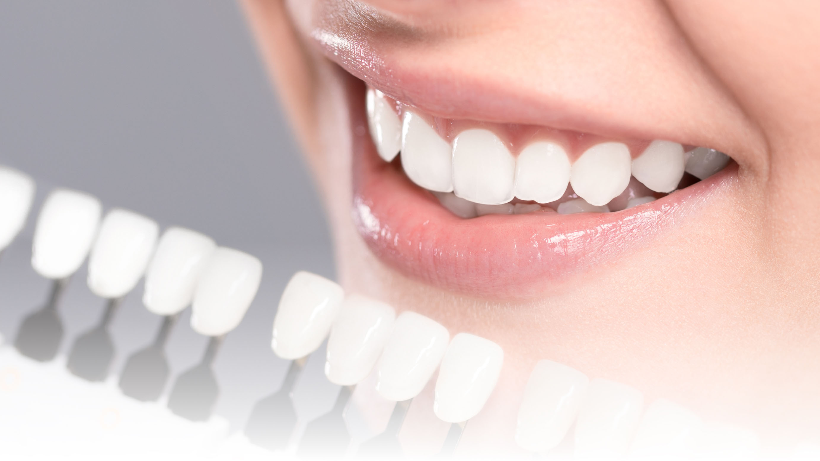 女性口元のきれいな歯と歯の白さの指標の写真