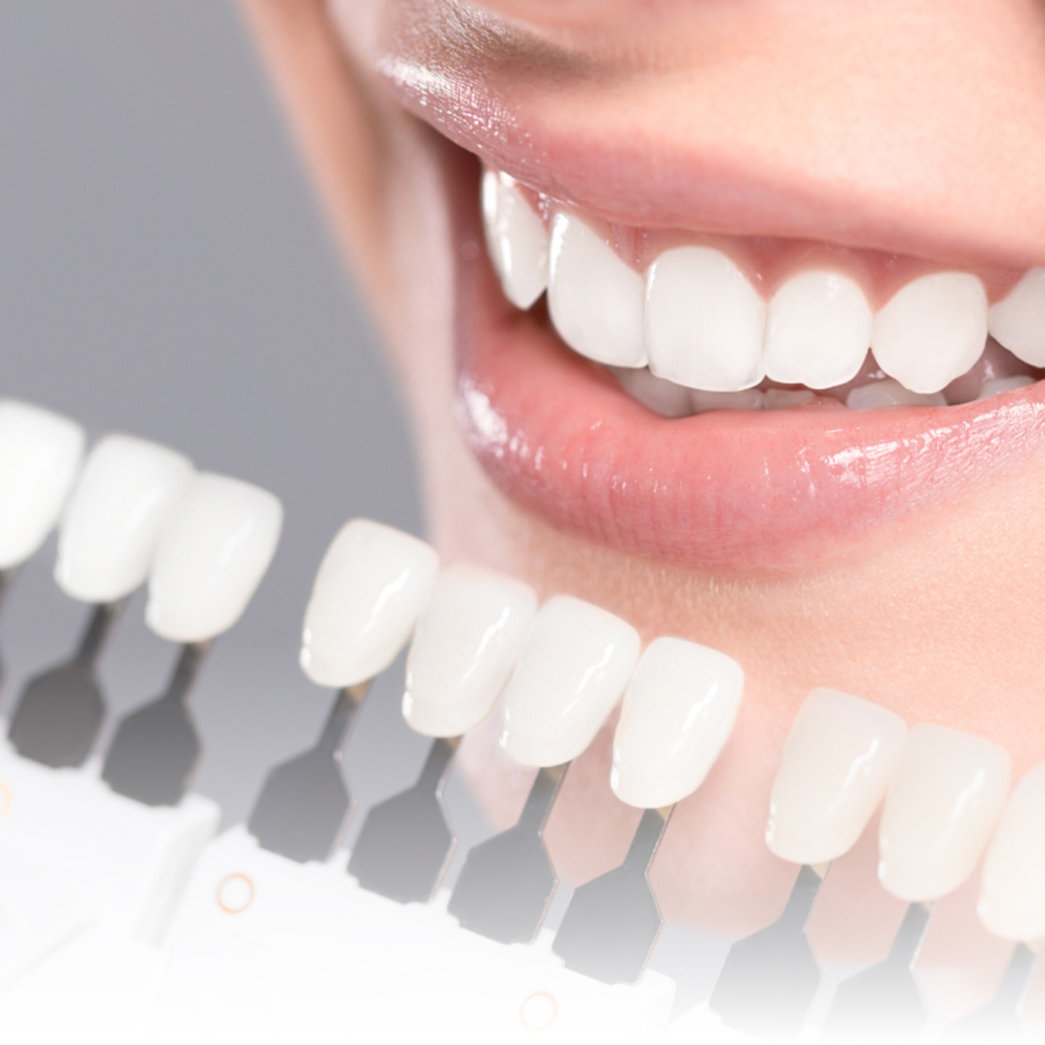 女性口元のきれいな歯と歯の白さの指標の写真